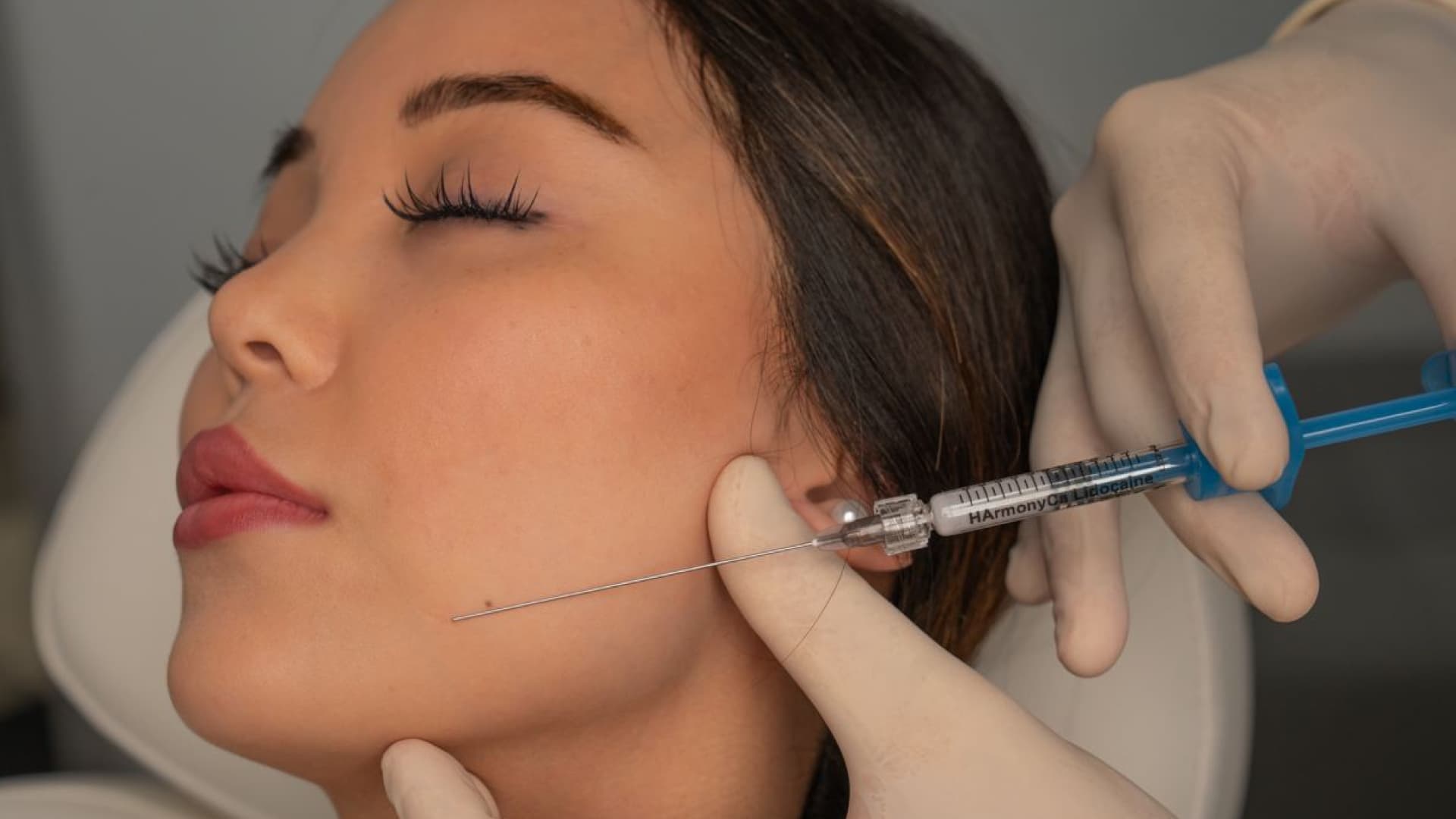 juvéderm Dermal Filler für Lippen und Gesicht bei MorySkin