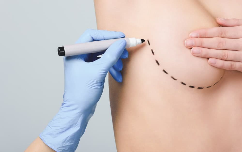Brustverkleinerung in der modernen plastischen Chirurgie